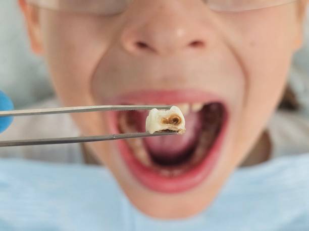 Best Emergency Treatment for Jaw Pain or Injury in St Elmo, IL